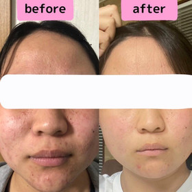 before after